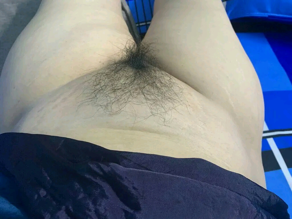 155377