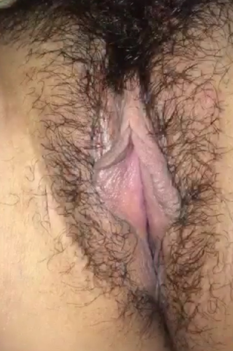 14161