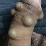 0888661246